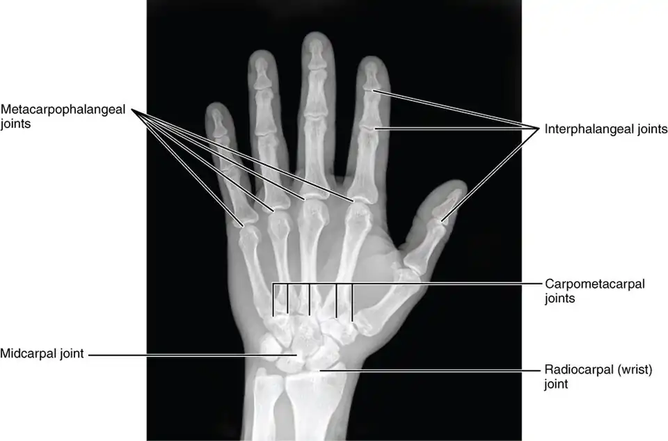 X-ray