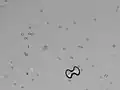 Urine microscopy showing a calcium oxalate monohydrate crystal (dumbbell shaped) and a calcium oxalate dihydrate crystal (envelope shaped) along with several erythrocytes.