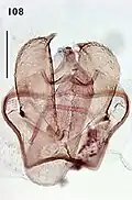 Male genitalia