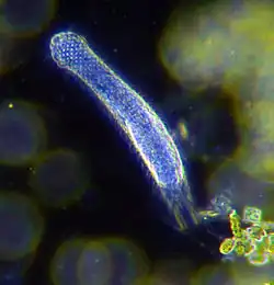 Darkfield photo of a gastrotrich, 0.06-3.0&nbsp;mm long, a worm-like animal living between sediment particles