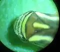 Head under magnification. Dededo, Guam