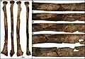 Burial 15. Perimortem fractures on the left radius