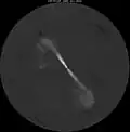 NGC 5532 in radio waves by the Very Large Array