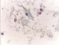 The cytoplasms of squamous epithelial cells melted out; many Döderlein bacilli can be seen.
