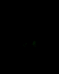Postcentral gyrus highlighted in green on transversal T1 MRI images