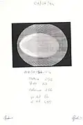Axial image obtained from the first Cone-Beam 3D Scan performed on July 1, 1994[6]