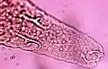 Terminal lappet