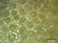 Higher magnification of the leaf surface, showing the trigones–cell wall thickenings in the corners between neighboring cells.