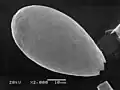 Euglypha, a prominent genus of testate amoebae