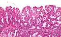 Intermediate magnification micrograph of an SSL.