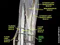 Radial artery and vein