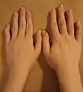 Comparison, posterior